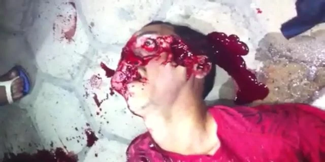 A Dude With A Skull Shot Torn Apart Was Trying To Tell Us Something